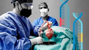 Organ transplantation